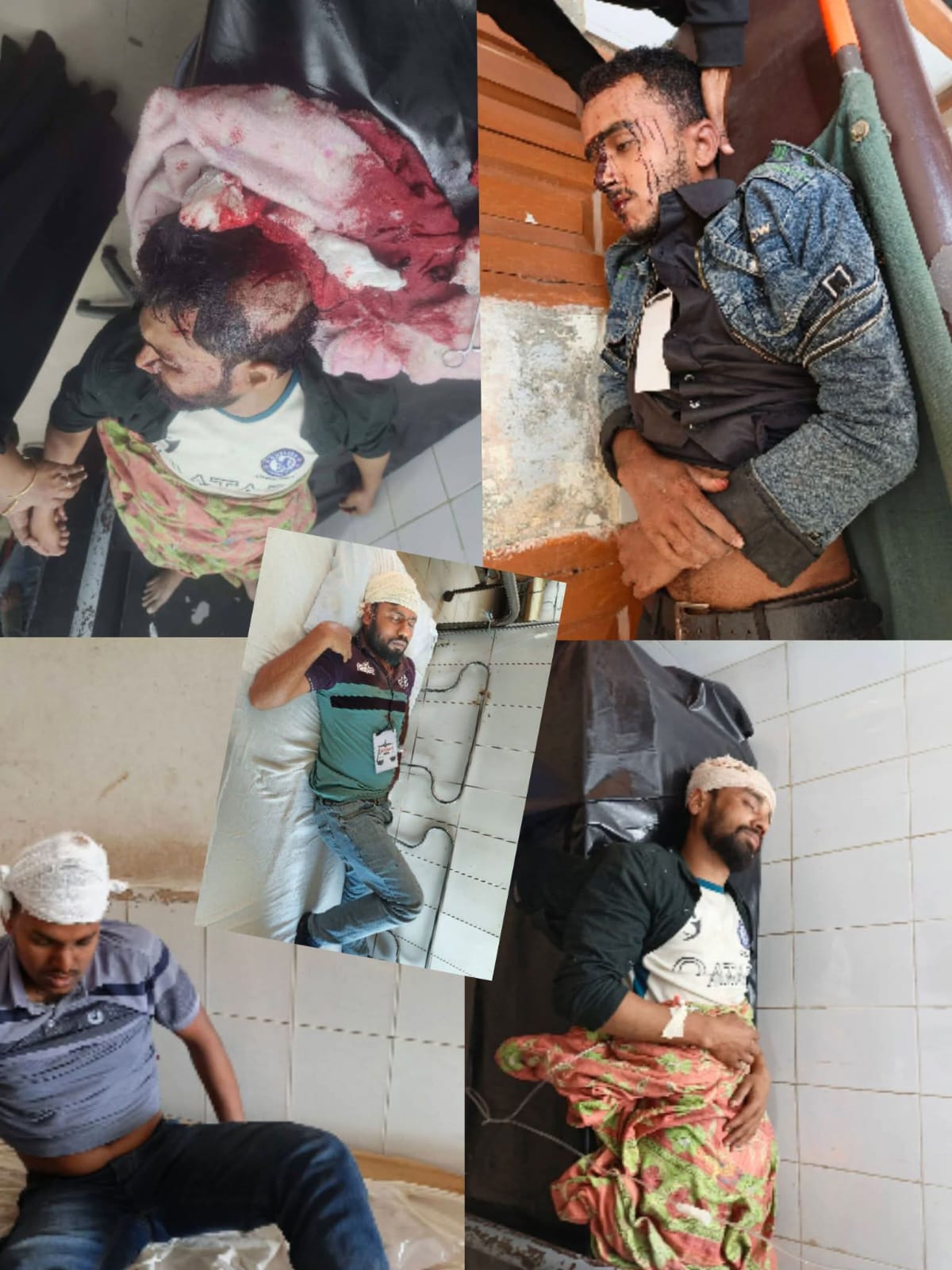 শরনখোলার সোনাতলা ভোটকেন্দ্রের আধা কিলোমিটার দুরে বি এন পি জামাত সংঘর্ষে আহত ১৯ জন 
