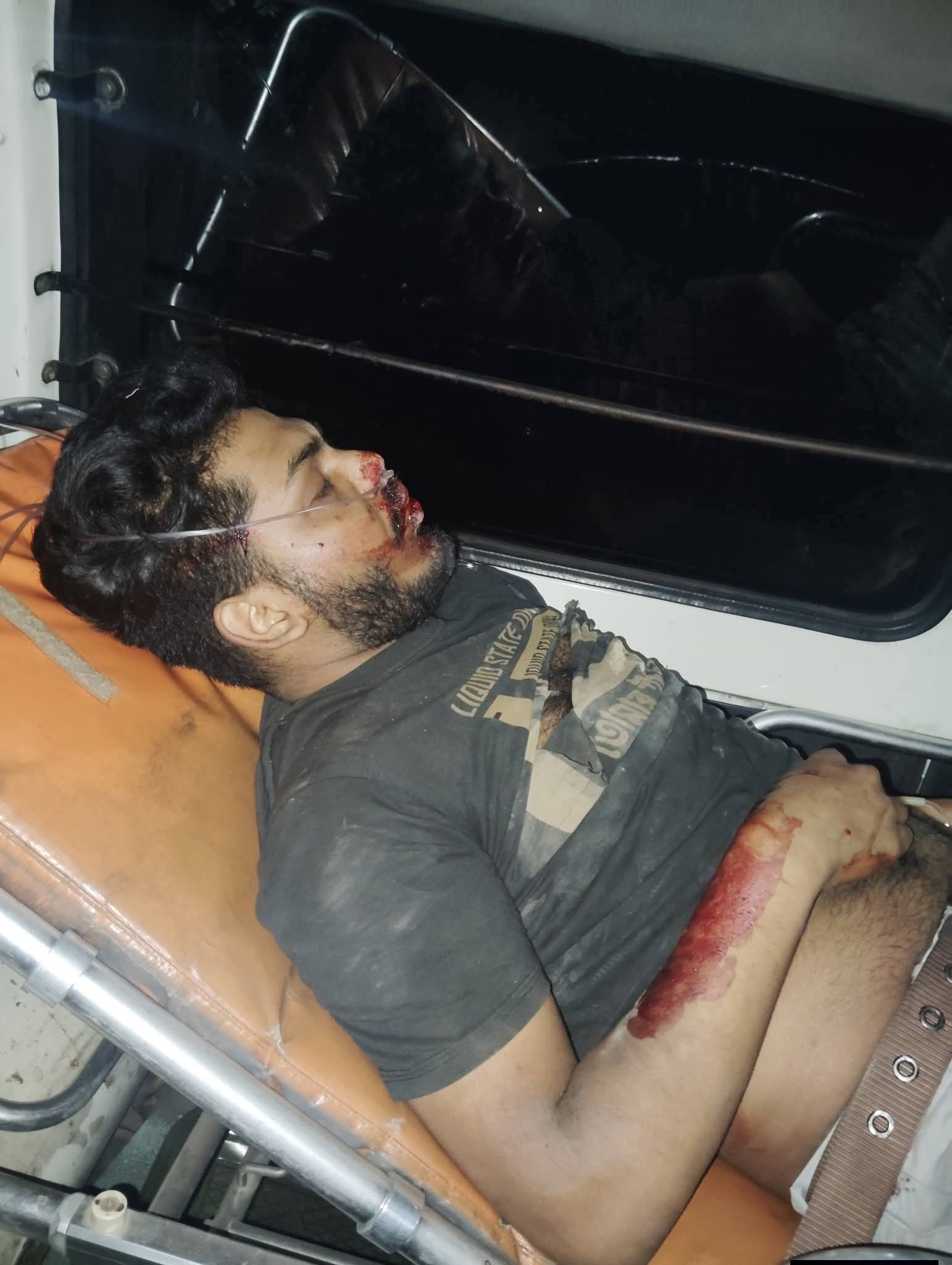 মিরসরাইয়ে মহাসড়কে মৃত্যুফাঁদ: ৪ গাড়ির সংঘর্ষে ট্রাকের ৫ টন স্টিল বান্ডেল ছিটকে পথচারী নিহত, আহত ৩