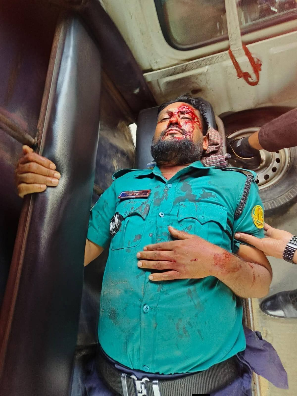 সিলেটে মোটরসাইকেল সিগন্যাল দেয়ায় হামলার শিকার পুলিশ সদস্য।
