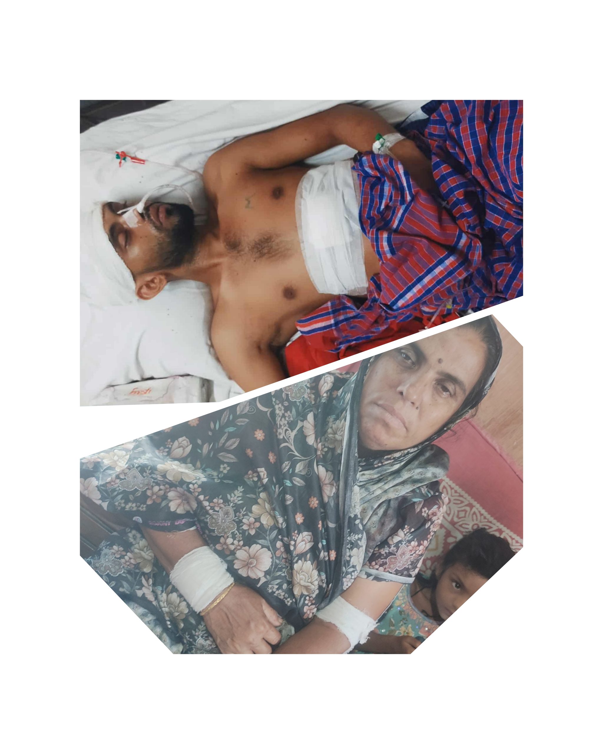 কুমিরায় পাওনা টাকা চাইতে গিয়ে সংখ্যালঘু পরিবারের তিন সদস্যকে কুপিয়ে জখম, চমেকে ভর্তি
